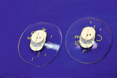 Fertig geblockte Gläser Fertig geblockte Gläser